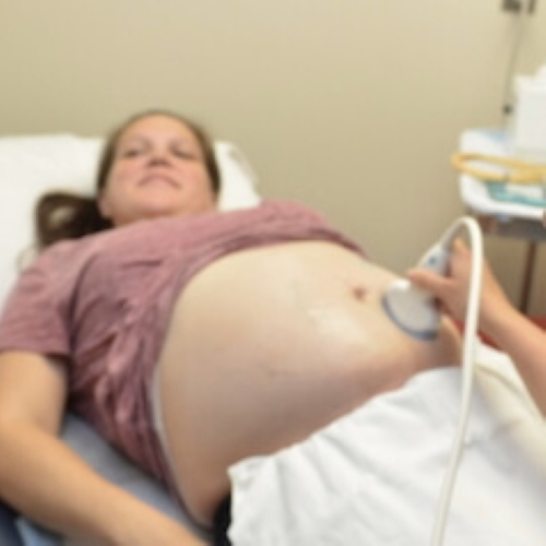 prenatal ultrasound