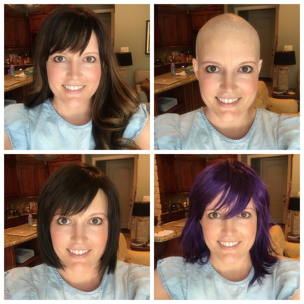 Alison's Stage 4 Triple-Positive Metastatic Breast Cancer Story - The  Patient Story