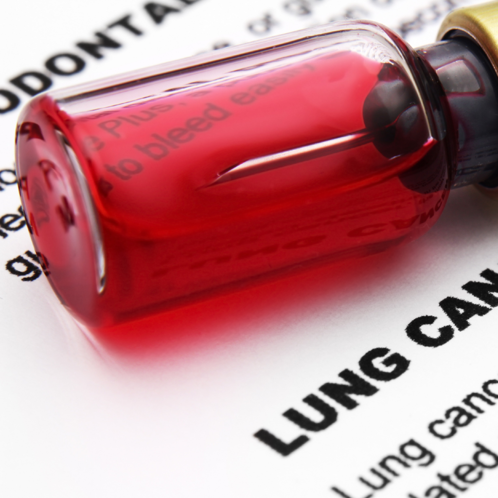 lung-cancer-its-symptoms-tests-and-treatment-methods