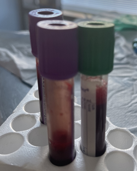 Tamsin W. blood tests