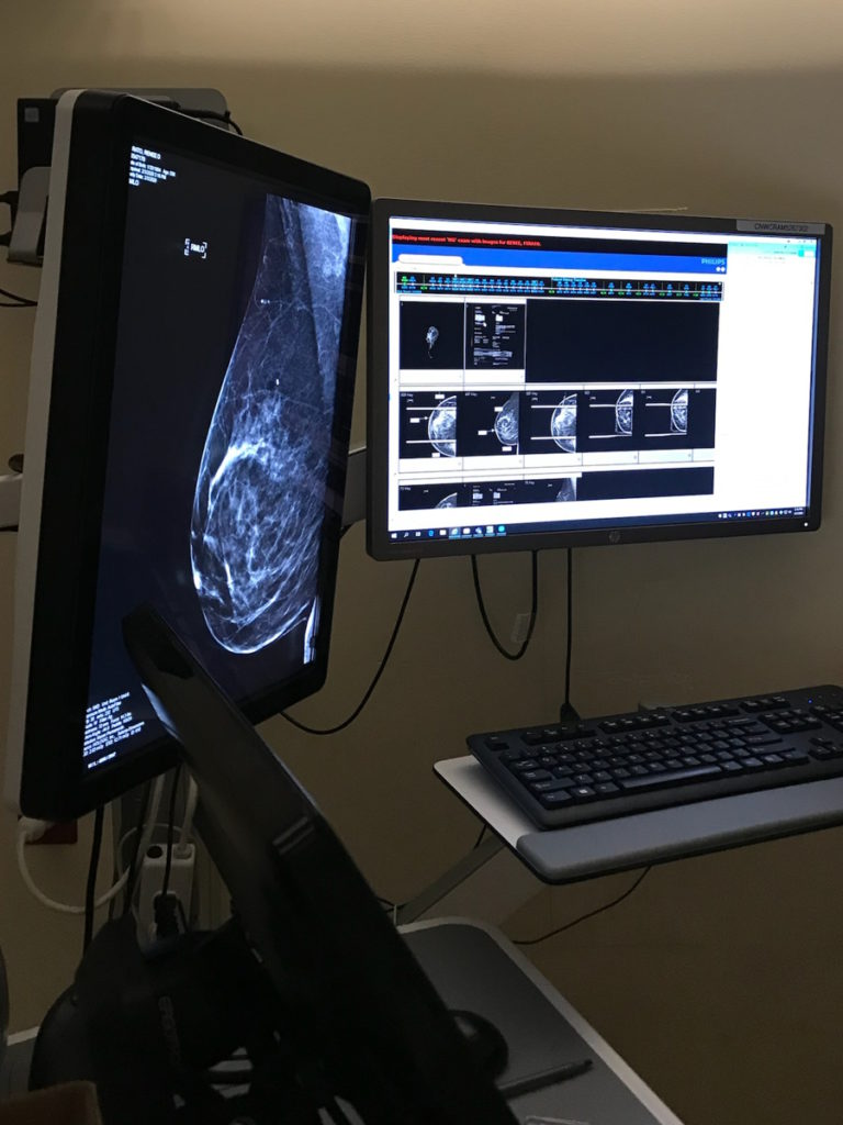 Renee F. breast scan results on monitor