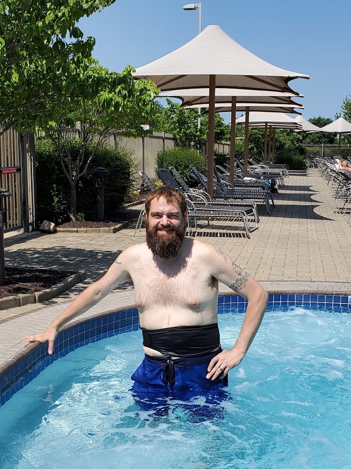 Jason swims 3-4 times a day with his colostomy bag