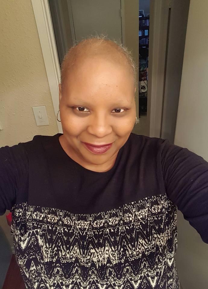 Megan Claire shaved her head before it fell out due to chemo