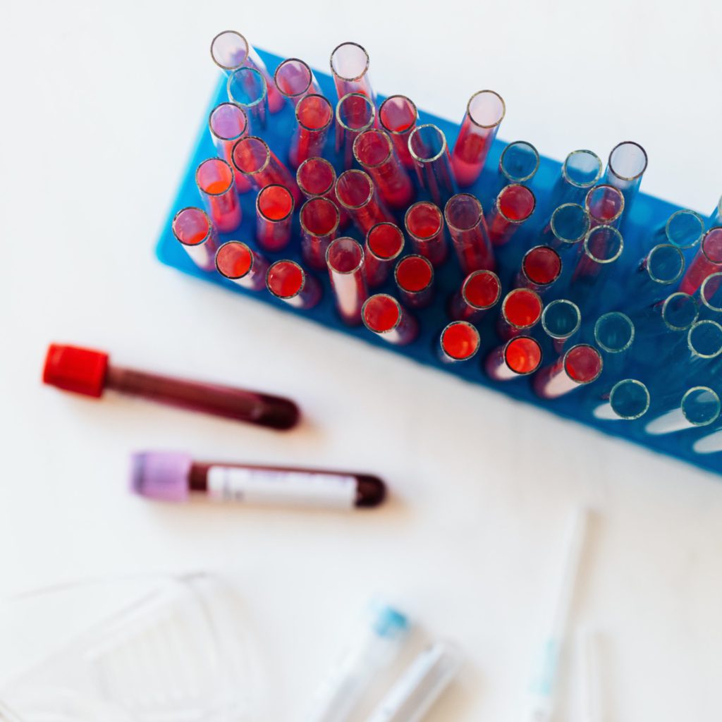 blood test vials for a CBC test.