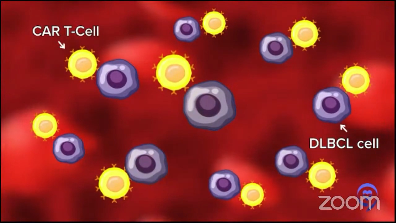 The Latest in DLBCL Treatments - Clinical Trials