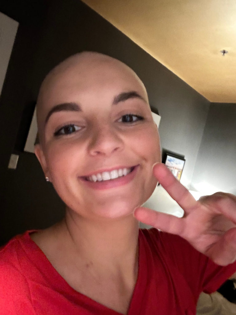 Danielle discusses hair loss after cancer