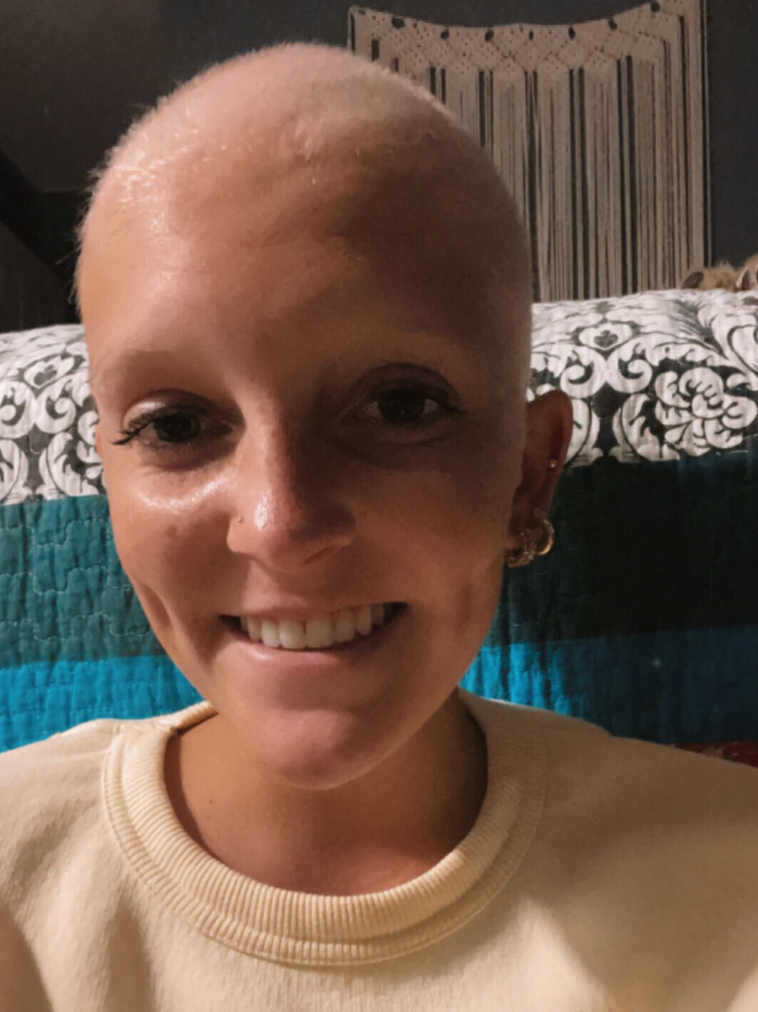 Sammie discusses hair loss from chemo