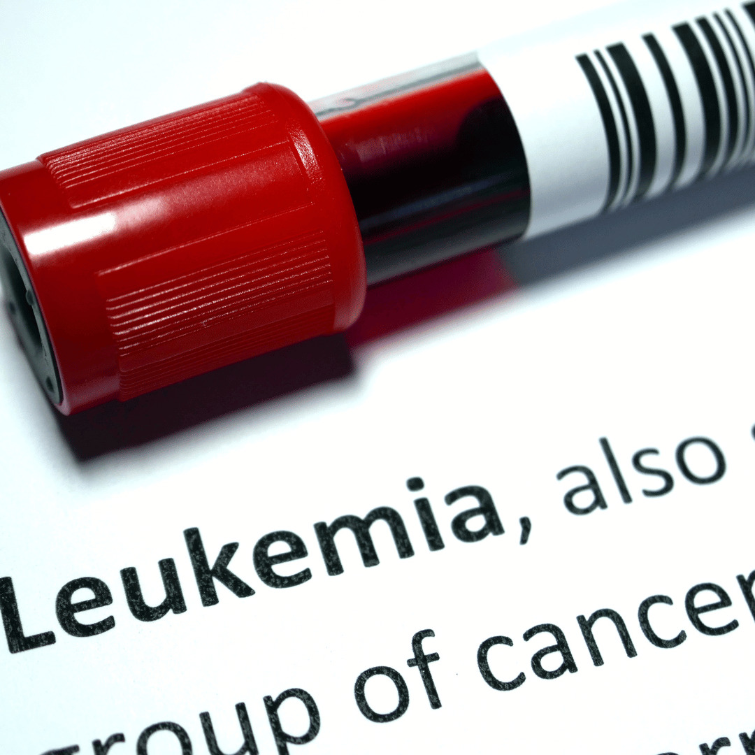 Leukemia vial of blood with a definition of the cancer