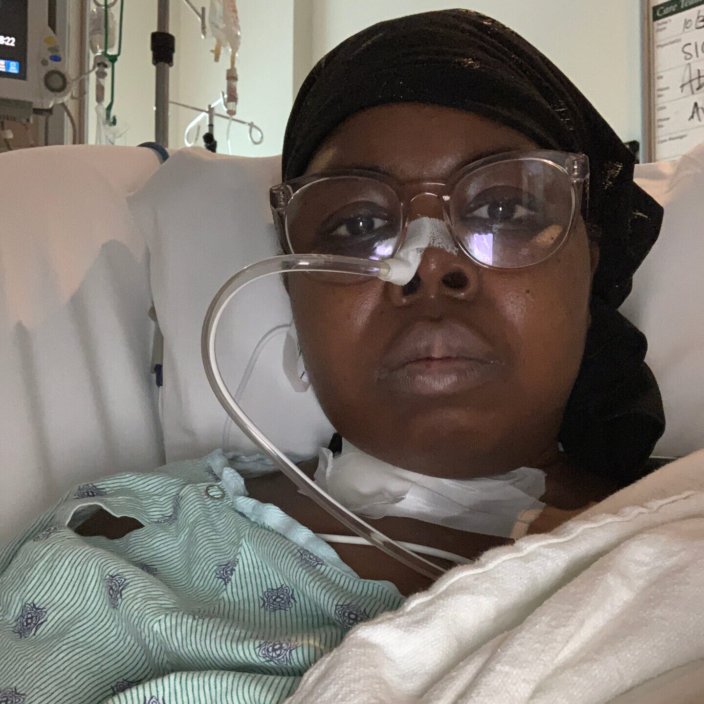 Zykeisha shares her side effects from chemo