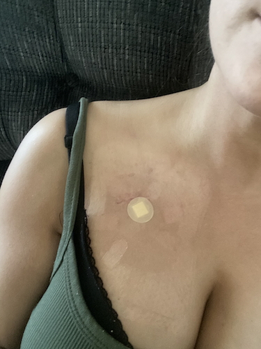 Crystal W. colon cancer