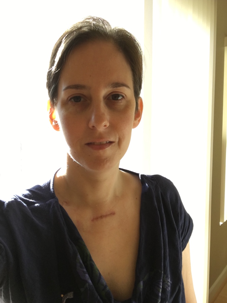 Laura P. stage 4 Hodgkin Lymphoma