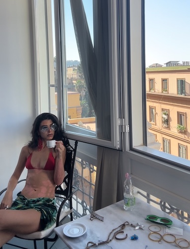Alana O. psoriasis and psoriatic arthritis
