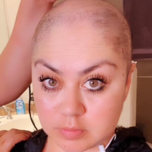 Brittany B. stage 3.75 ovarian cancer