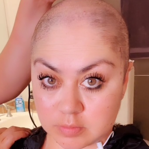 Brittany B. stage 3.75 ovarian cancer