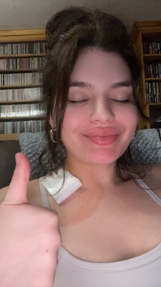 Ciarra D. dermatofibrosarcoma