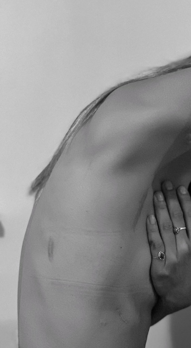 Julie K. stage 4 synovial sarcoma