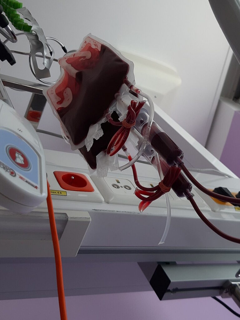 blood transfusion