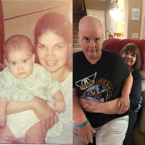 Kim C. stage 2B ovarian cancer