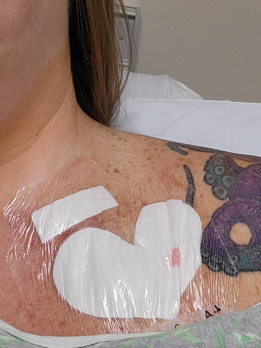 Kristen P. stage 4 small cell lung cancer