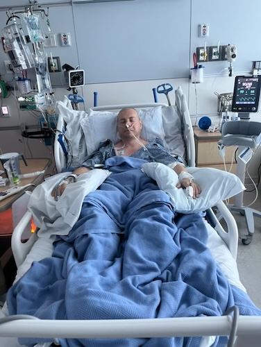Mark S. stage 2 esophageal cancer
