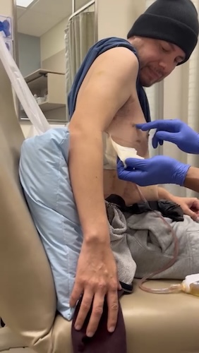 Mark S. stage 2 esophageal cancer