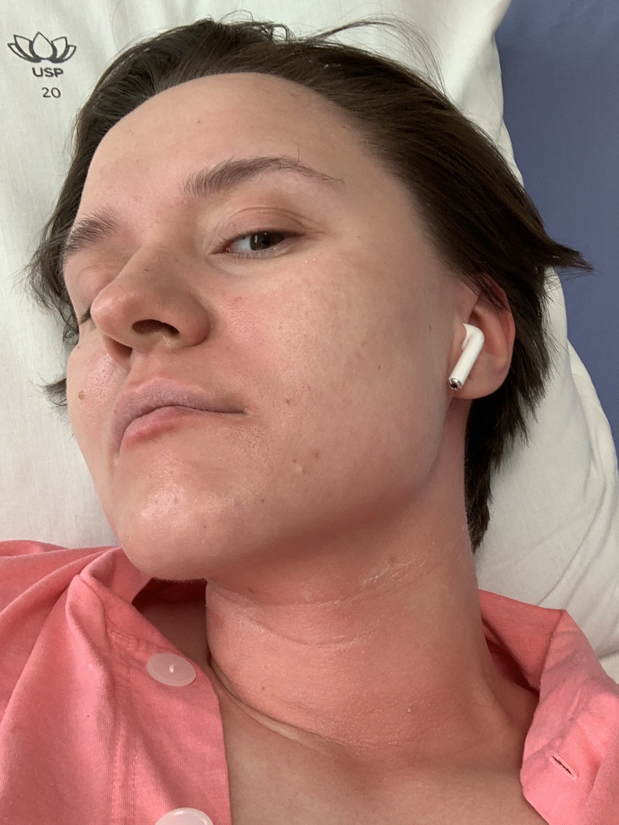 Sasha F. stage 4 ocular melanoma
