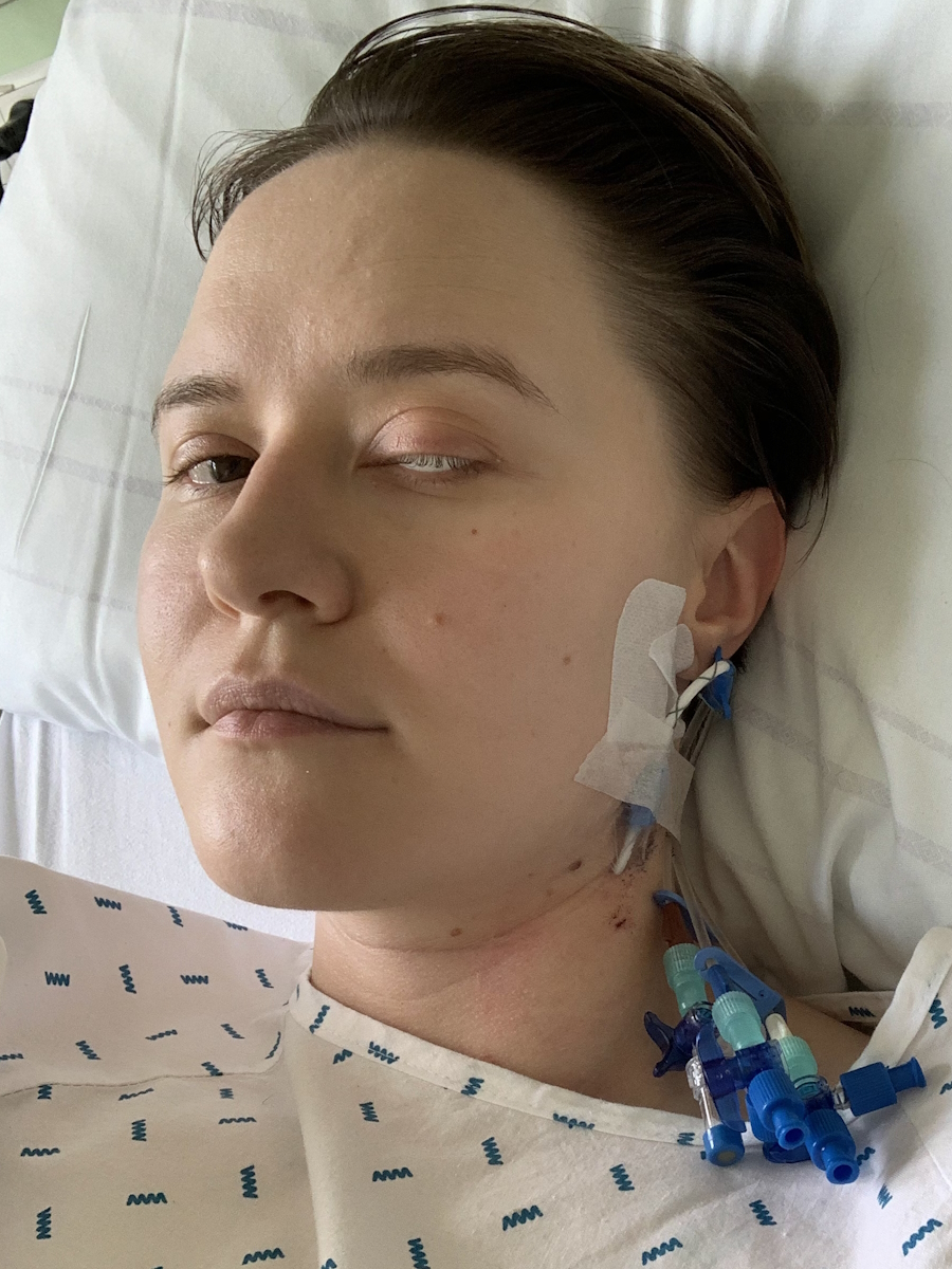 Sasha F. stage 4 ocular melanoma