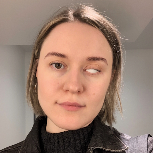 Sasha F. stage 4 ocular melanoma