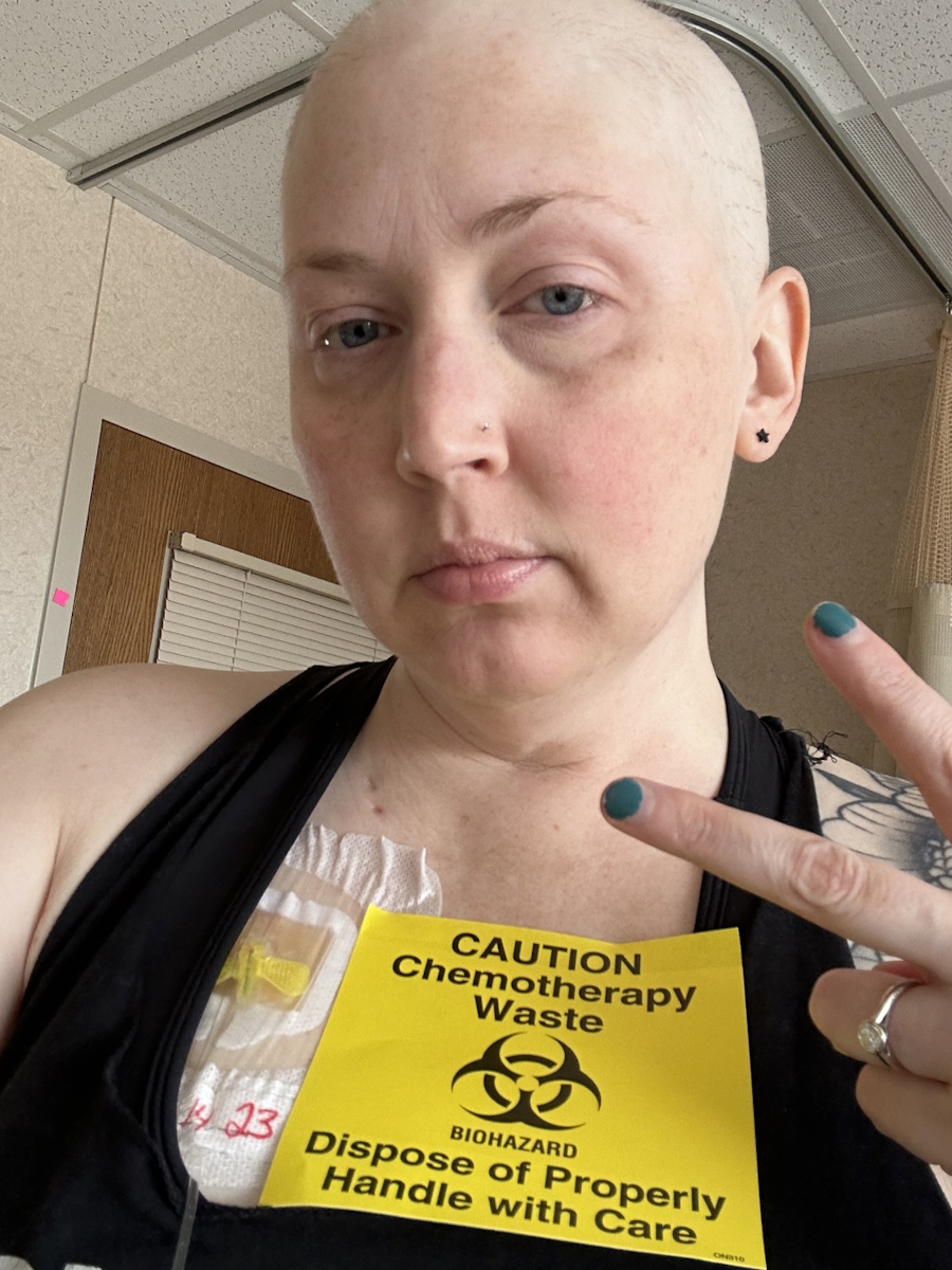 Shannon W. choriocarcinoma