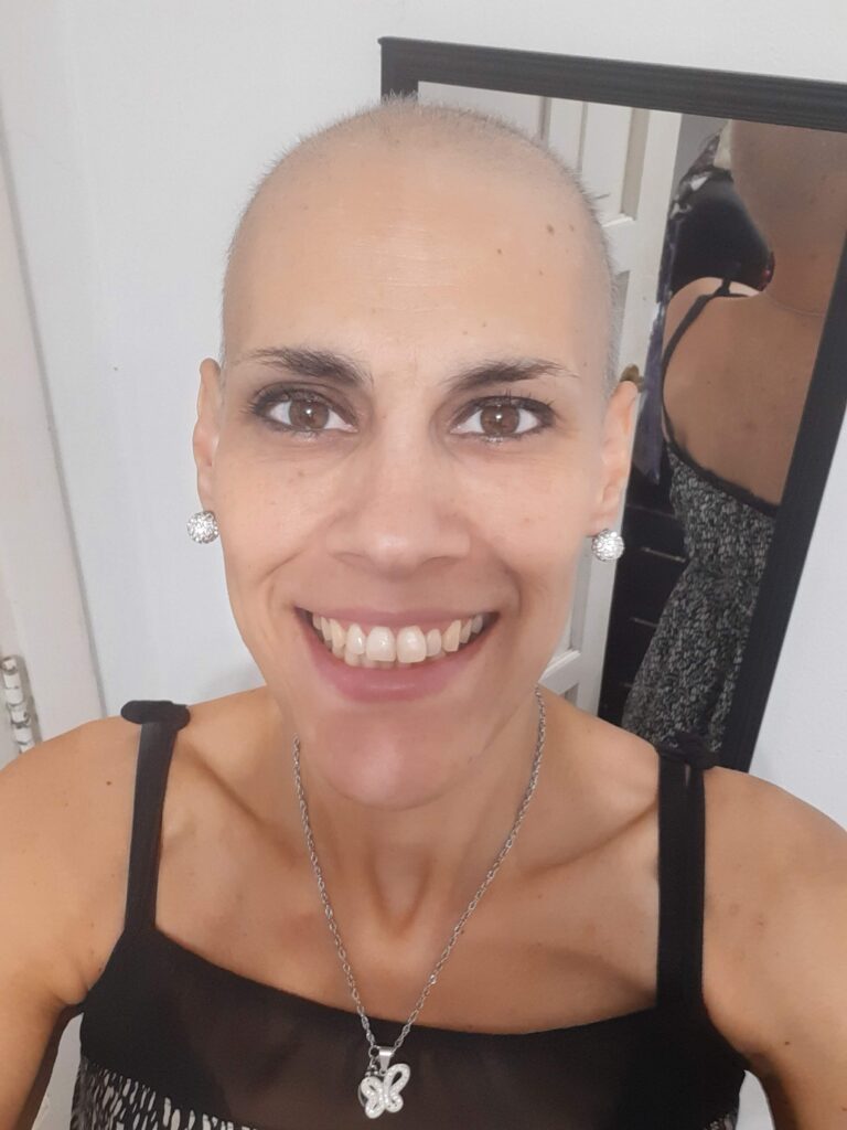 Fiorella G. stage 2 breast cancer
