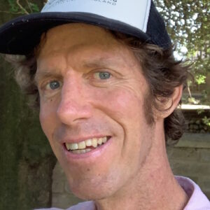 Mart H. melanoma