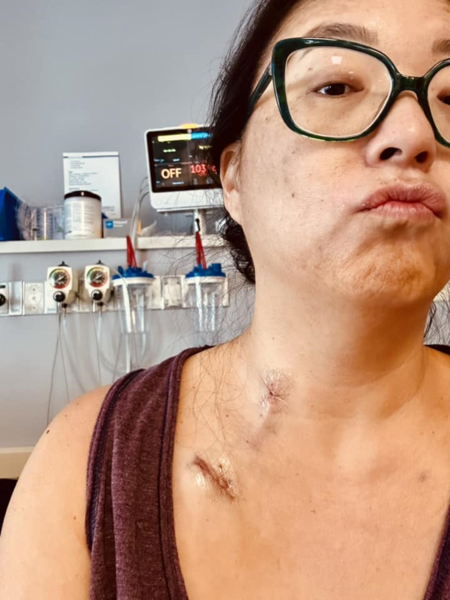 Emily N. stage 4 EGFR+ lung cancer