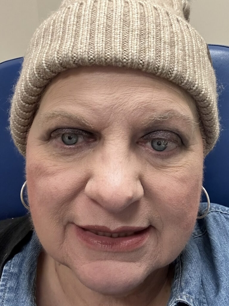 Mary M. stage 4B endometrial cancer