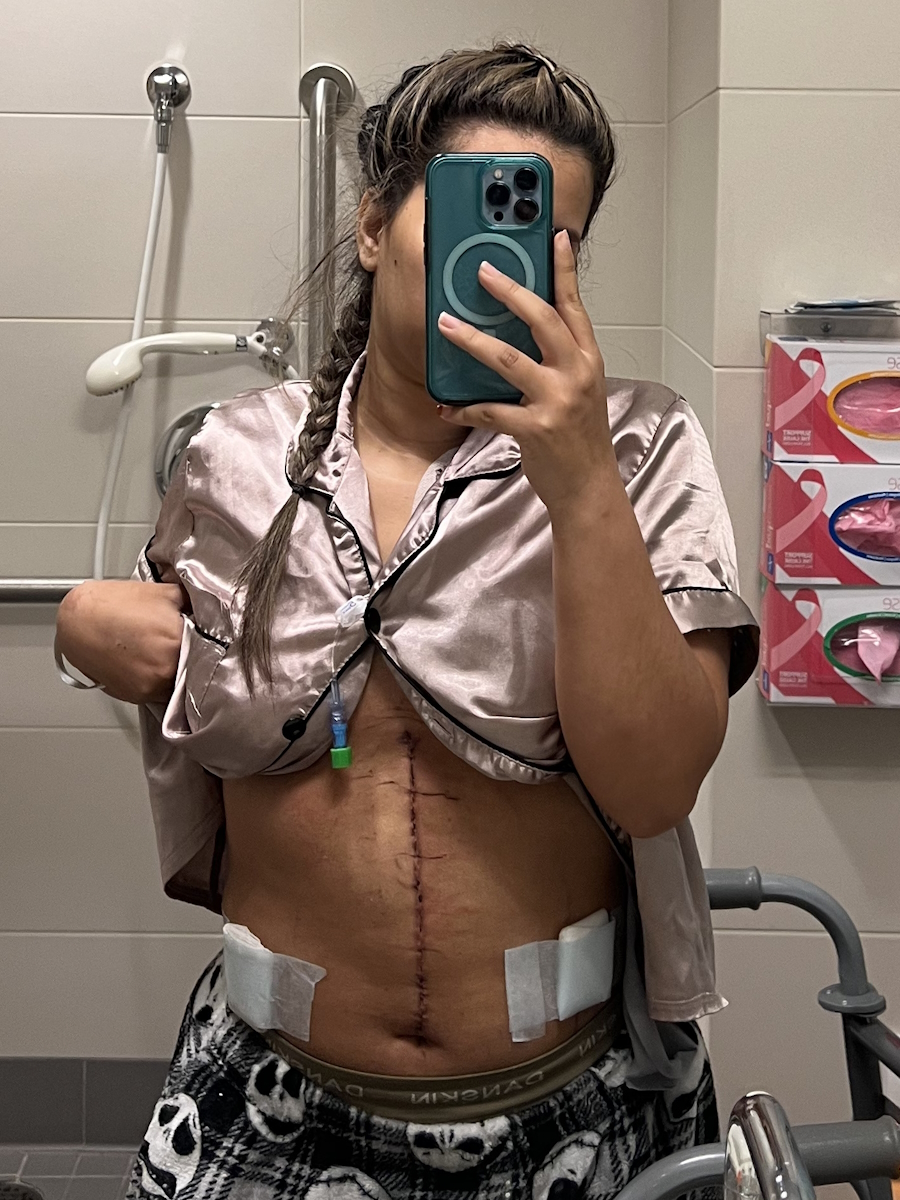 Tabbie V. neuroendocrine pancreatic cancer