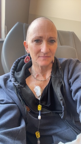 AJ H. cervical cancer