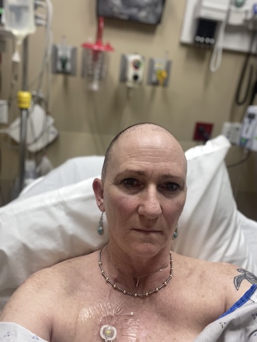 AJ H. cervical cancer