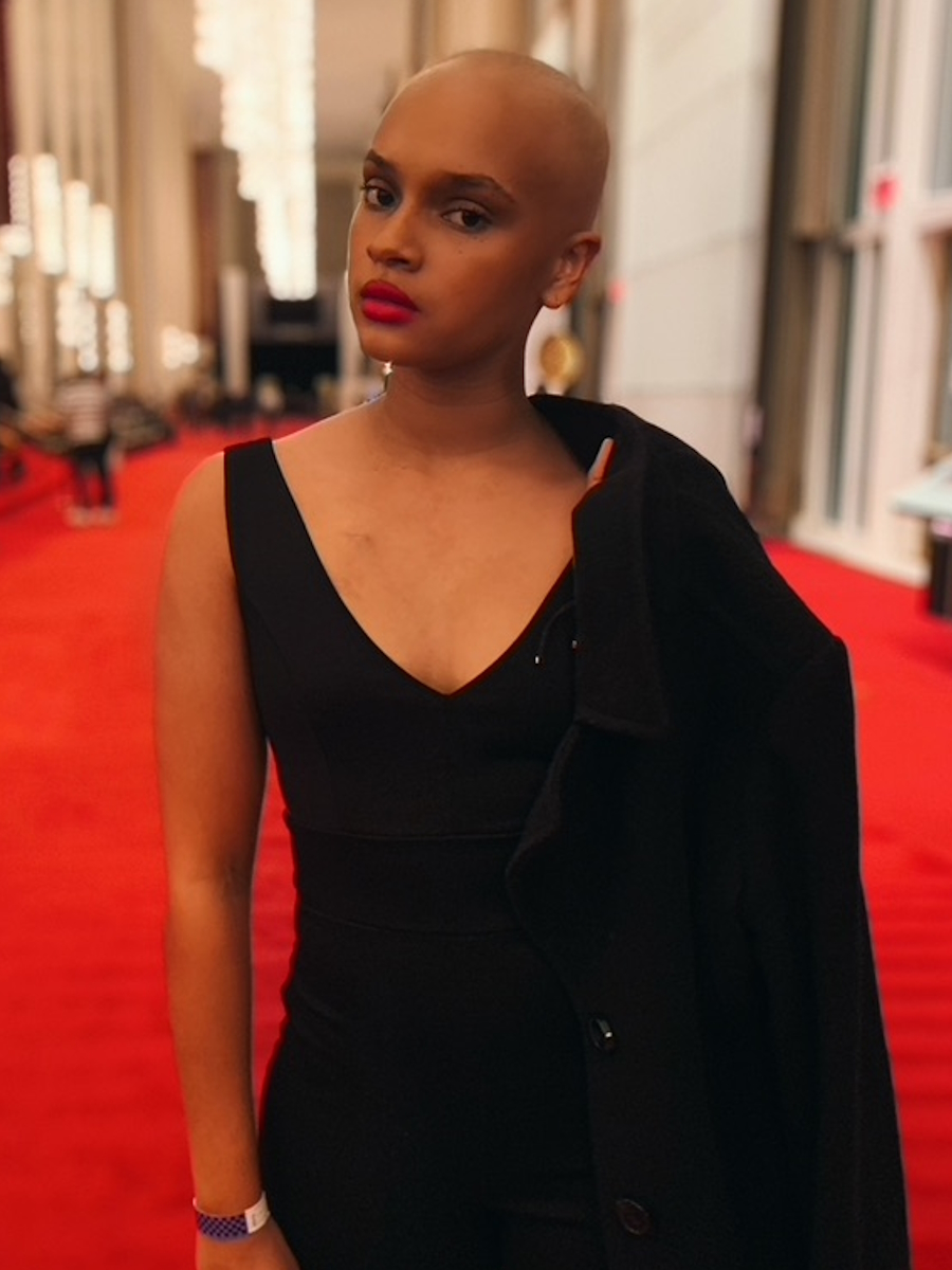 Amina V. stage 4B Hodgkin's lymphoma
