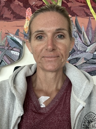 Starr S. colon cancer