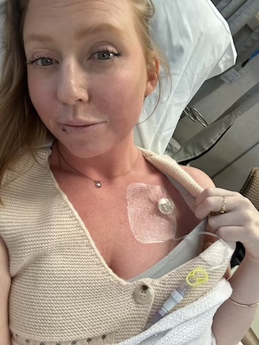 Beth R. tongue cancer