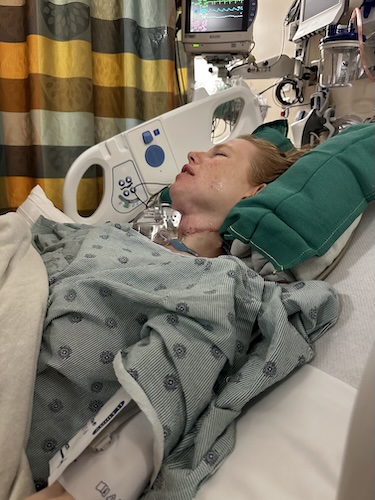 Beth R. tongue cancer