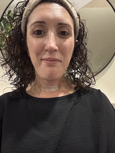 Cyndi F. thyroid cancer