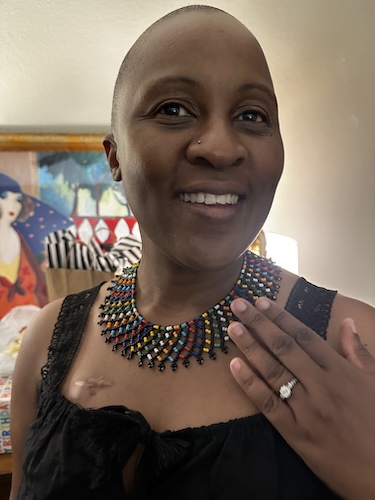 Dalitso N. invasive ductal carcinoma breast cancer