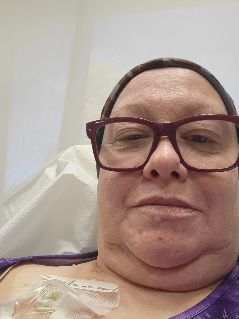 Kandie D. endometrial cancer