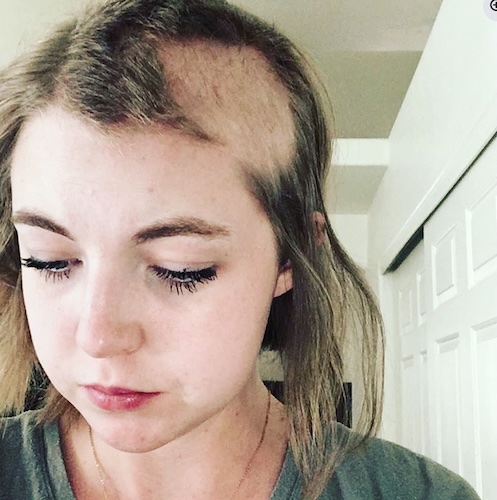 Kelsea K. brain cancer