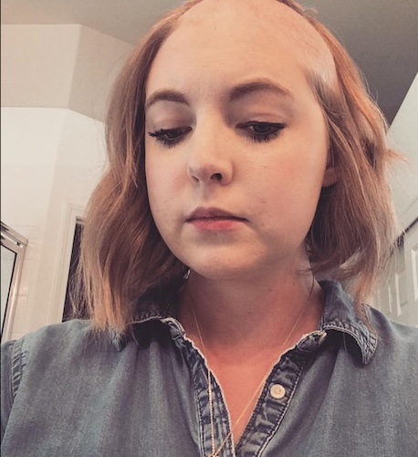Kelsea K. brain cancer