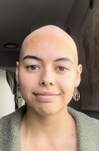 McKenna A. synovial sarcoma