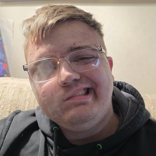 Michael J. brain cancer