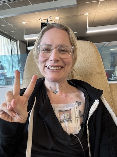 Nicole B. triple-negative breast cancer