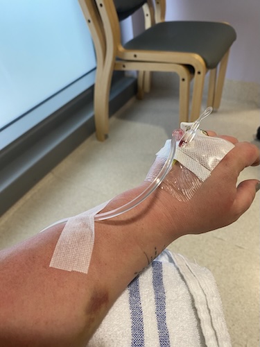 Pippa S. vulvar cancer