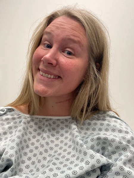 Ali C. adenoid cystic carcinoma